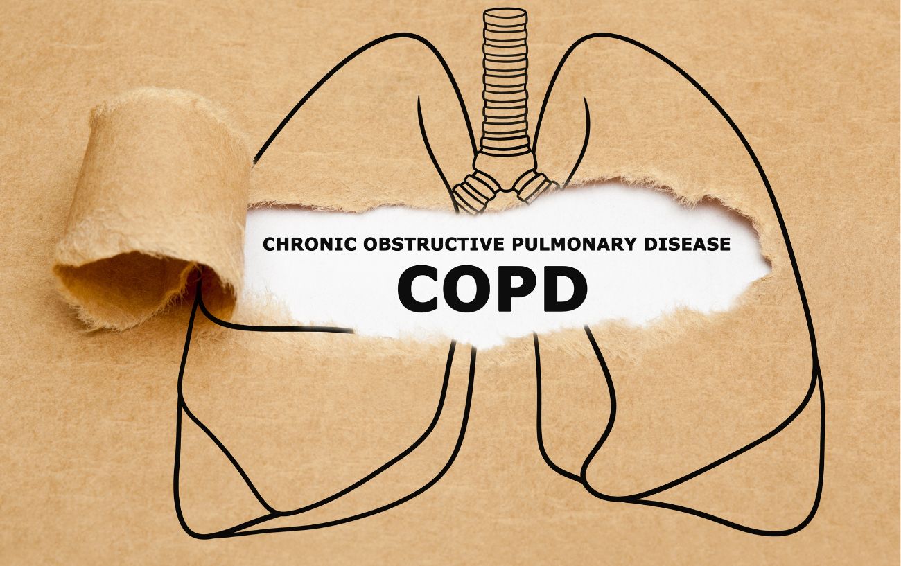 5 Breathing Exercises For COPD: Effective Relief The Simple Way