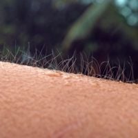 hair standing up on someone's arm